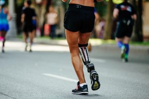 back female runner disability in prosthesis